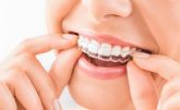 InterORALIA explica los beneficios de la ortodoncia Invisalign