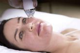 Tcnica de resurfacing facial para mejorar la piel del rostro, con Alluring Clinic