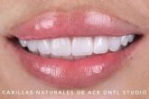 ACE DNTL STUDIO; Redefiniendo la Odontologa en Marbella