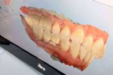 Clnicas Nobel transforma el diagnstico dental con simulaciones avanzadas en tiempo real