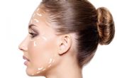 I-FACE esthetic es el lifting facial sin cirugía, rápido y natural