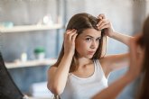 La dermatitis seborreica y su vinculacin real con la cada del cabello