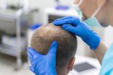 El 50% de la poblacin espanola padece alopecia, y de ellos, un 90% es de carcter andrognico