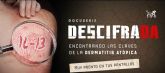 LEO Pharma y la Asociacin de Afectados por la Dermatitis Atpica lanzan DescifraDA, una serie documental sobre esta enfermedad